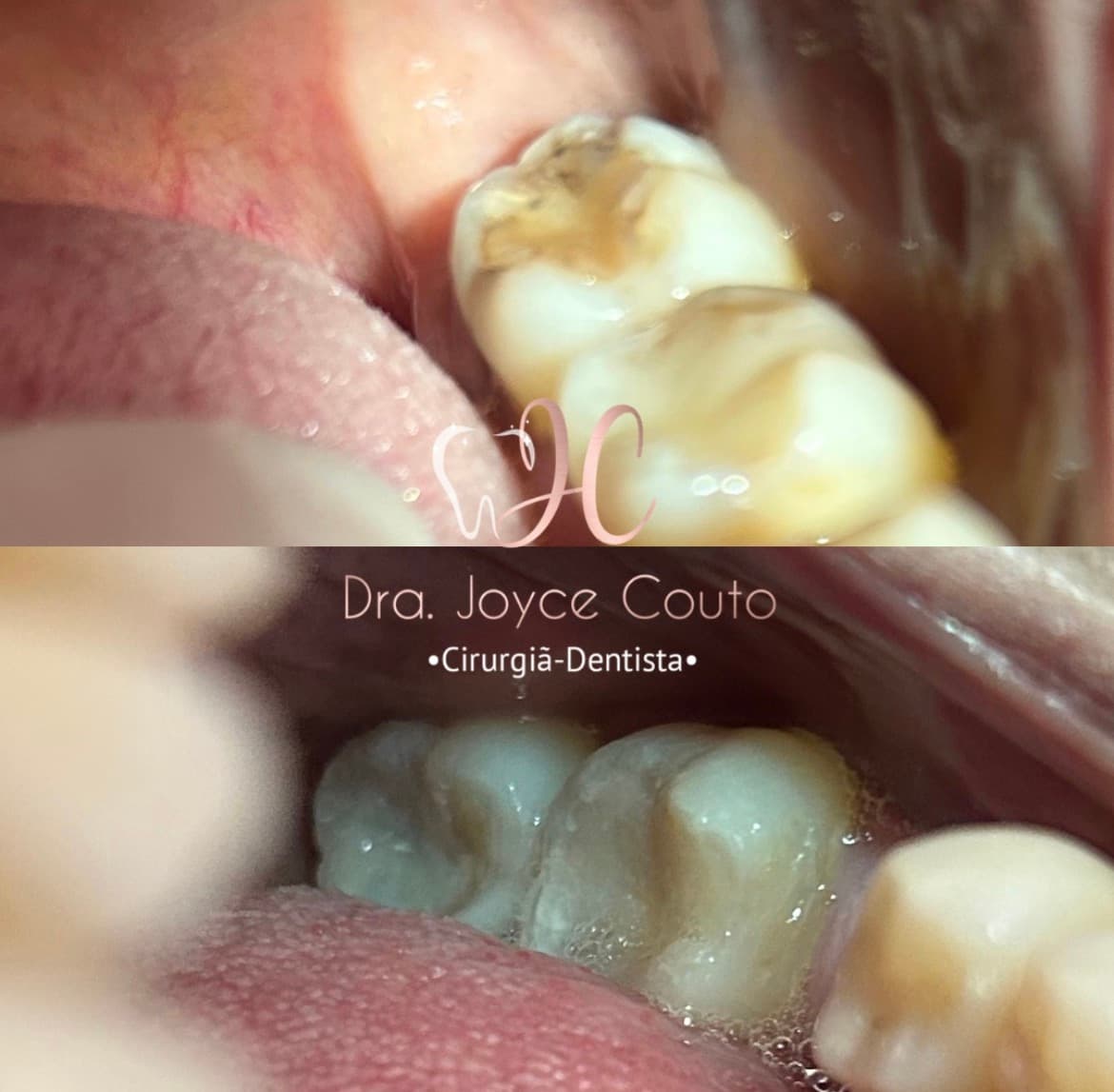 Antes e depois de restauração